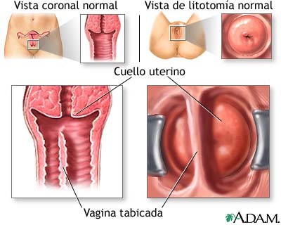 Trastornos en el desarrollo de la vagina y la vulva