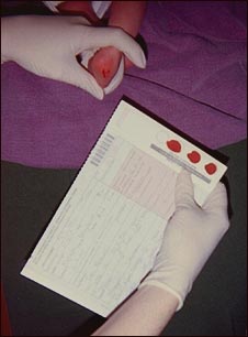 Examen de fenilcetonuria