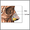 Cirugía plástica de la nariz (rinoplastia) - Serie