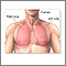 Lobectomía pulmonar - Serie