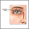 Glándula lacrimal