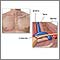 Anatomía de la salida del tórax