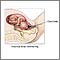 Monitorización fetal interna
